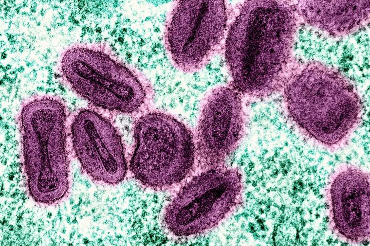 Virología en nuestro idioma: proponen que en español se utilice el término anfitrión en lugar de huésped u hospedero